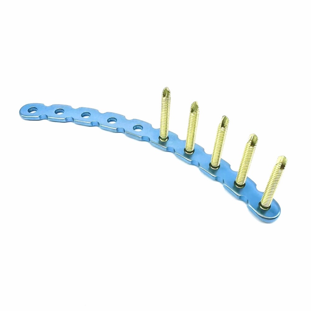 Arc Reconstruction Locking Plate