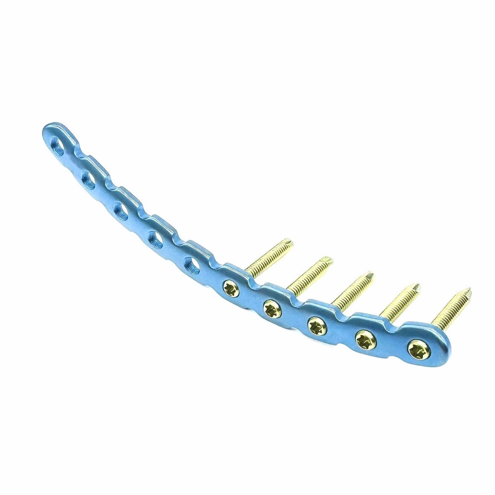 Arc Reconstruction Locking Plate